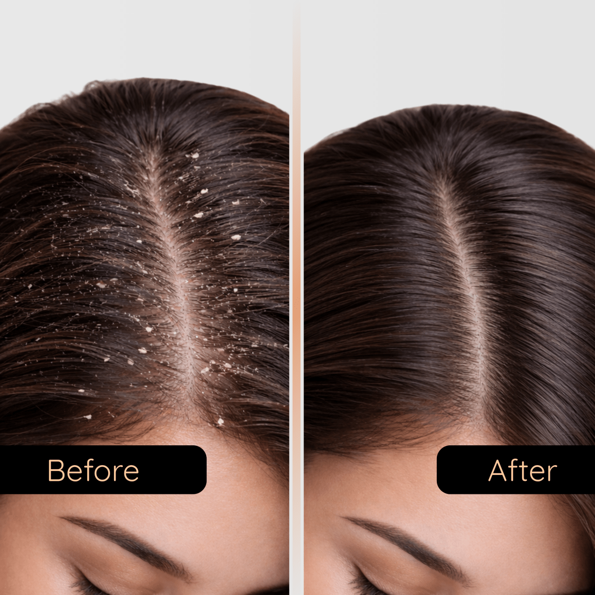 Black Soil Shampoo - Control Dandruff & Hair Repair | 250g