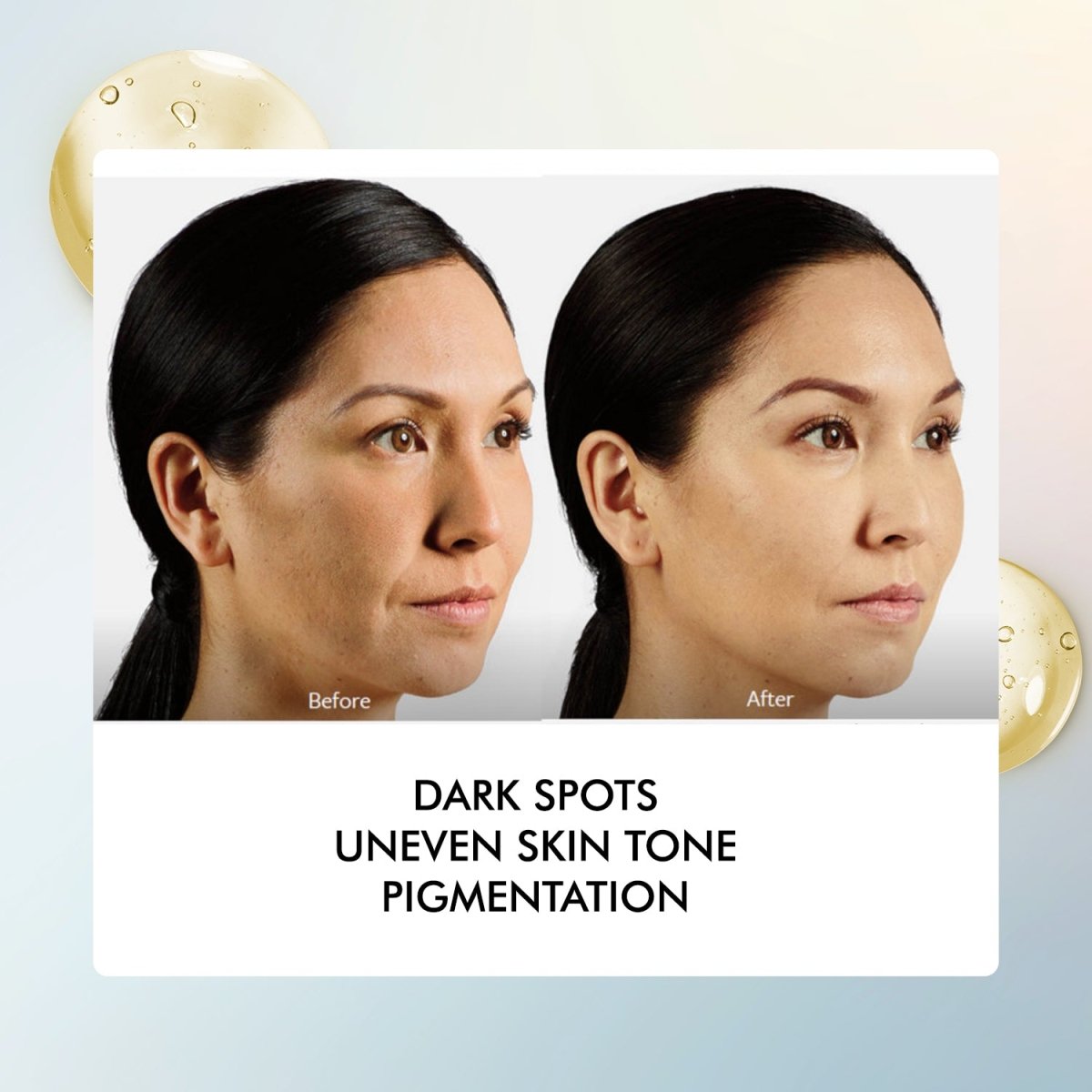 20% Vitamin C Serum for Bright & Even Skin Tone
