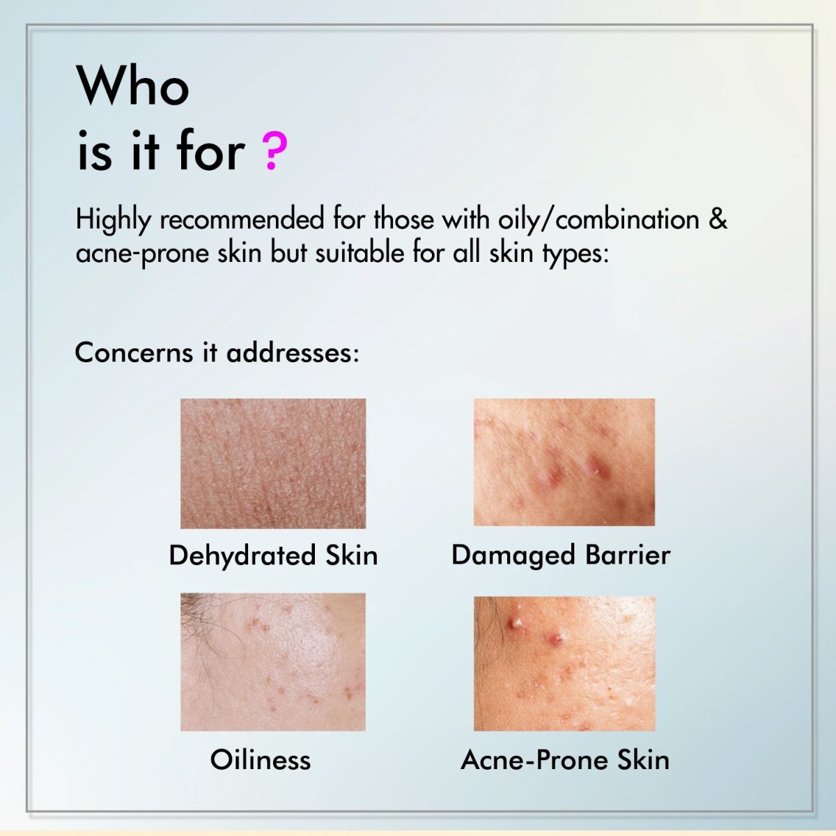 20% Vitamin C Serum for Bright & Even Skin Tone